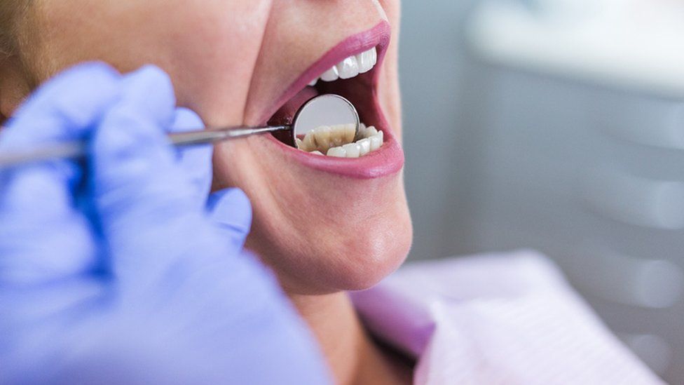 Dental Cleaning
